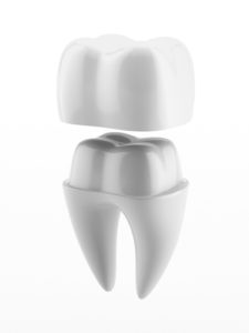 dental crowns denver co